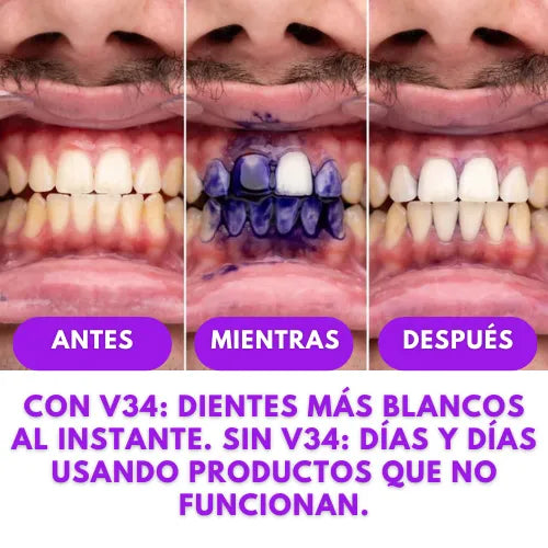 Crema V34 Sonrisa Radiante En Segundos